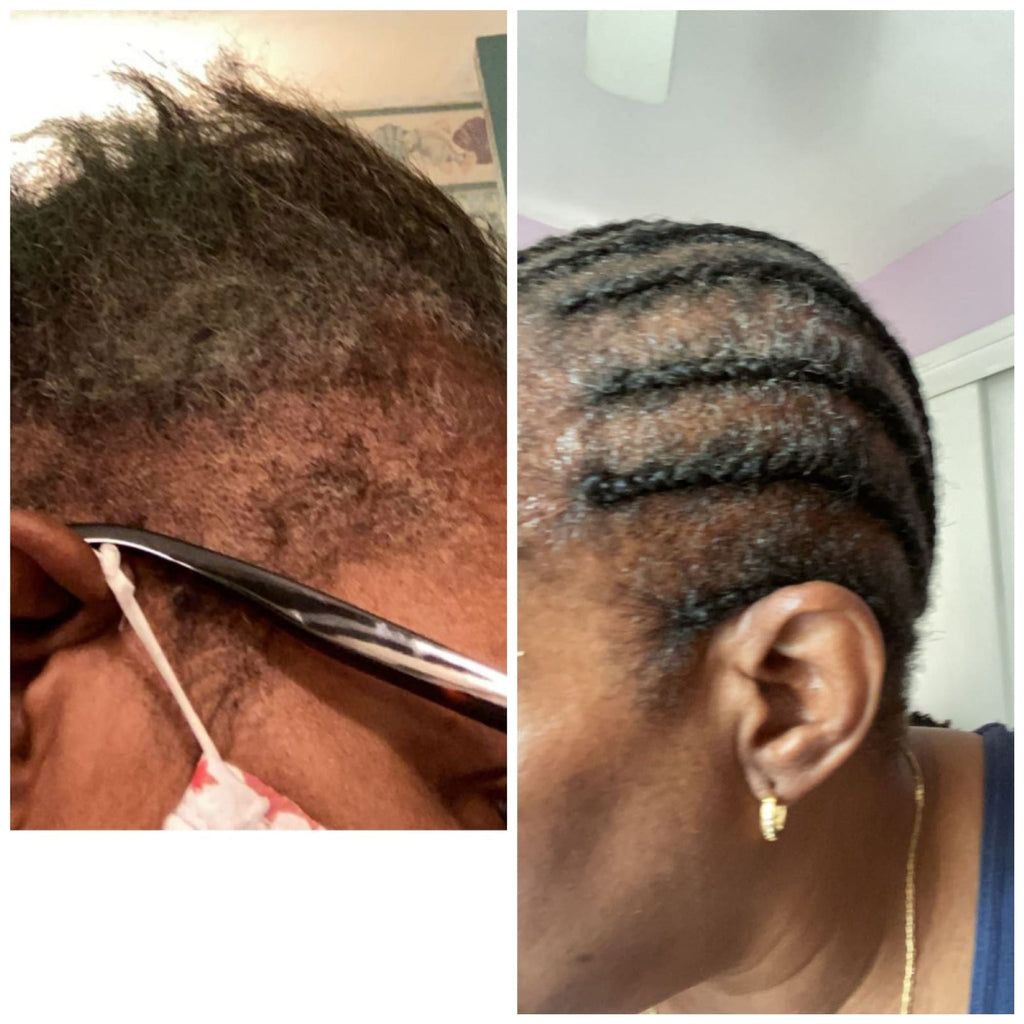 Hair Regrowth Serum-with Peppermint Oil, Tea Tree Oil, Argan oil, Jojoba seed, Avocado oil, Castor oil, Sweet Almond, Vitamin E Oil for Scalp and Hair